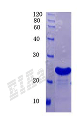 Human BACE1 Protein