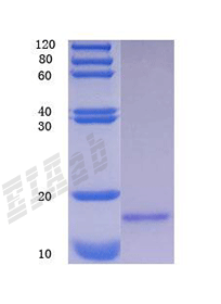 Human HIF1A Protein