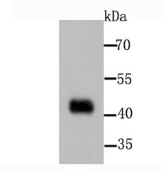 Human PDK1 Monoclonal Antibody