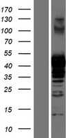 PRMT1 (NM_001536) Human Tagged ORF Clone