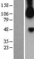 FGFR1 (NM_023110) Human Tagged ORF Clone