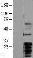 Bcl x(BCL2L1) (NM_138578) Human Tagged ORF Clone