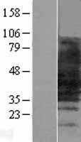 SLC10A1 (NM_003049) Human Tagged ORF Clone