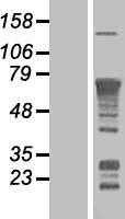 NF-kB p65(RELA) (NM_021975) Human Tagged ORF Clone