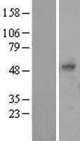 PDGF beta(PDGFB) (NM_002608) Human Tagged ORF Clone