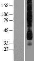 Glucose Transporter GLUT1(SLC2A1) (NM_006516) Human Tagged ORF Clone