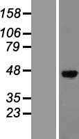 SPHK1 (NM_021972) Human Tagged ORF Clone