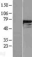 DDX5 (NM_004396) Human Tagged ORF Clone