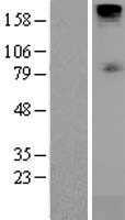 SGLT1(SLC5A1) (NM_000343) Human Tagged ORF Clone