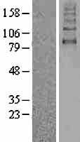 SGLT2(SLC5A2) (NM_003041) Human Tagged ORF Clone