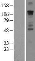 GLI1 (NM_005269) Human Tagged ORF Clone