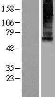 Mucolipin 1(MCOLN1) (NM_020533) Human Tagged ORF Clone