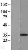 CD8A (NM_001768) Human Tagged ORF Clone