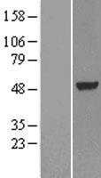 LXR alpha(NR1H3) (NM_005693) Human Tagged ORF Clone