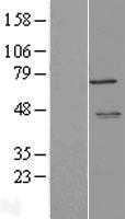 LYRIC(MTDH) (NM_178812) Human Tagged ORF Clone
