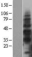 TIM 3(HAVCR2) (NM_032782) Human Tagged ORF Clone