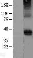 CD28 (NM_006139) Human Tagged ORF Clone