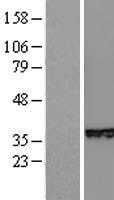 SLUG(SNAI2) (NM_003068) Human Tagged ORF Clone