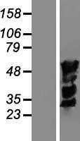 MUM1(IRF4) (NM_002460) Human Tagged ORF Clone