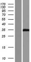 VSTM2B (NM_001146339) Human Tagged ORF Clone