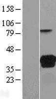 VSIG2 (NM_014312) Human Tagged ORF Clone