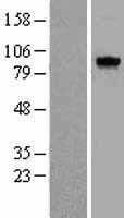 Mps1(TTK) (NM_003318) Human Tagged ORF Clone