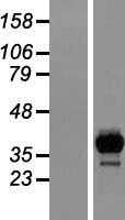 2 Hydroxy phytanoyl CoA lyase(HACL1) (NM_012260) Human Tagged ORF Clone