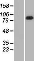 LRRC8A (NM_001127244) Human Tagged ORF Clone