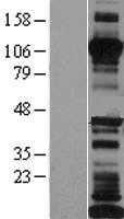 LI Cadherin(CDH17) (NM_004063) Human Tagged ORF Clone