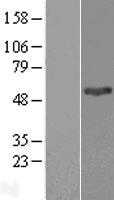 PNPLA3 (NM_025225) Human Tagged ORF Clone