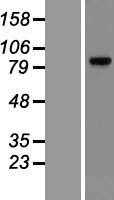 Glucocorticoid Receptor(NR3C1) (NM_001018074) Human Tagged ORF Clone