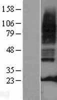 5HT3A receptor(HTR3A) (NM_213621) Human Tagged ORF Clone