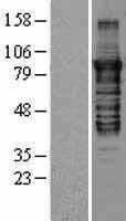 PKC epsilon(PRKCE) (NM_005400) Human Tagged ORF Clone