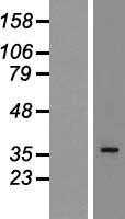 hnRNP A2B1(HNRNPA2B1) (NM_002137) Human Tagged ORF Clone
