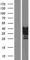 VSTM1 (NM_198481) Human Tagged ORF Clone