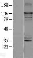 NFkB Inducing Kinase NIK(MAP3K14) (NM_003954) Human Tagged ORF Clone
