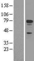 p73(TP73) (NM_005427) Human Tagged ORF Clone