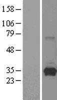 HPRT(HPRT1) (NM_000194) Human Tagged ORF Clone