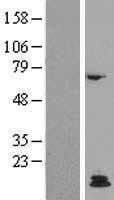 Parathyroid Hormone(PTH) (NM_000315) Human Tagged ORF Clone