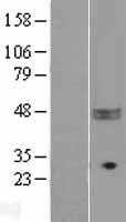 CD47 (NM_001777) Human Tagged ORF Clone