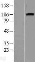 Neuropilin 1(NRP1) (NM_003873) Human Tagged ORF Clone