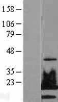 Histone H2A.X(H2AFX) (NM_002105) Human Tagged ORF Clone