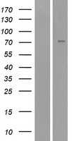 epithelial Sodium Channel alpha(SCNN1A) (NM_001038) Human Tagged ORF Clone