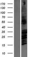 NMDAR2B(GRIN2B) (NM_000834) Human Tagged ORF Clone