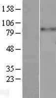 CD61(ITGB3) (NM_000212) Human Tagged ORF Clone