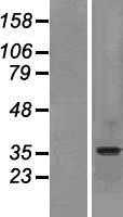 SLC10A2 (NM_000452) Human Tagged ORF Clone