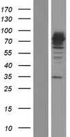 15 Lipoxygenase 2(ALOX15B) (NM_001039130) Human Tagged ORF Clone