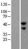 Nogo Receptor(RTN4R) (NM_023004) Human Tagged ORF Clone