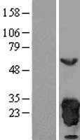 Peroxiredoxin 3(PRDX3) (NM_006793) Human Tagged ORF Clone
