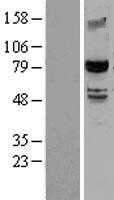 SMURF 2(SMURF2) (NM_022739) Human Tagged ORF Clone